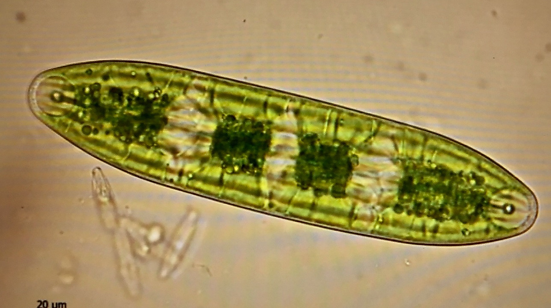 Zieralge Netrium interruptum